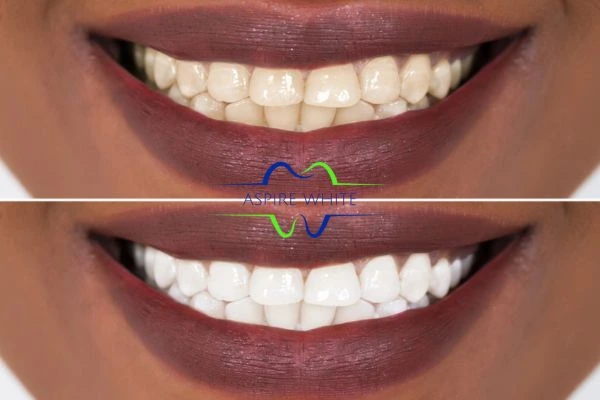 Side-by-side comparison showing before and after results of a cosmetic treatment Swindon