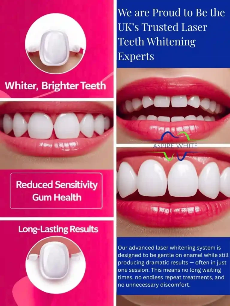 We are Proud to Be the UK’s Trusted Laser Teeth Whitening Experts Swindon