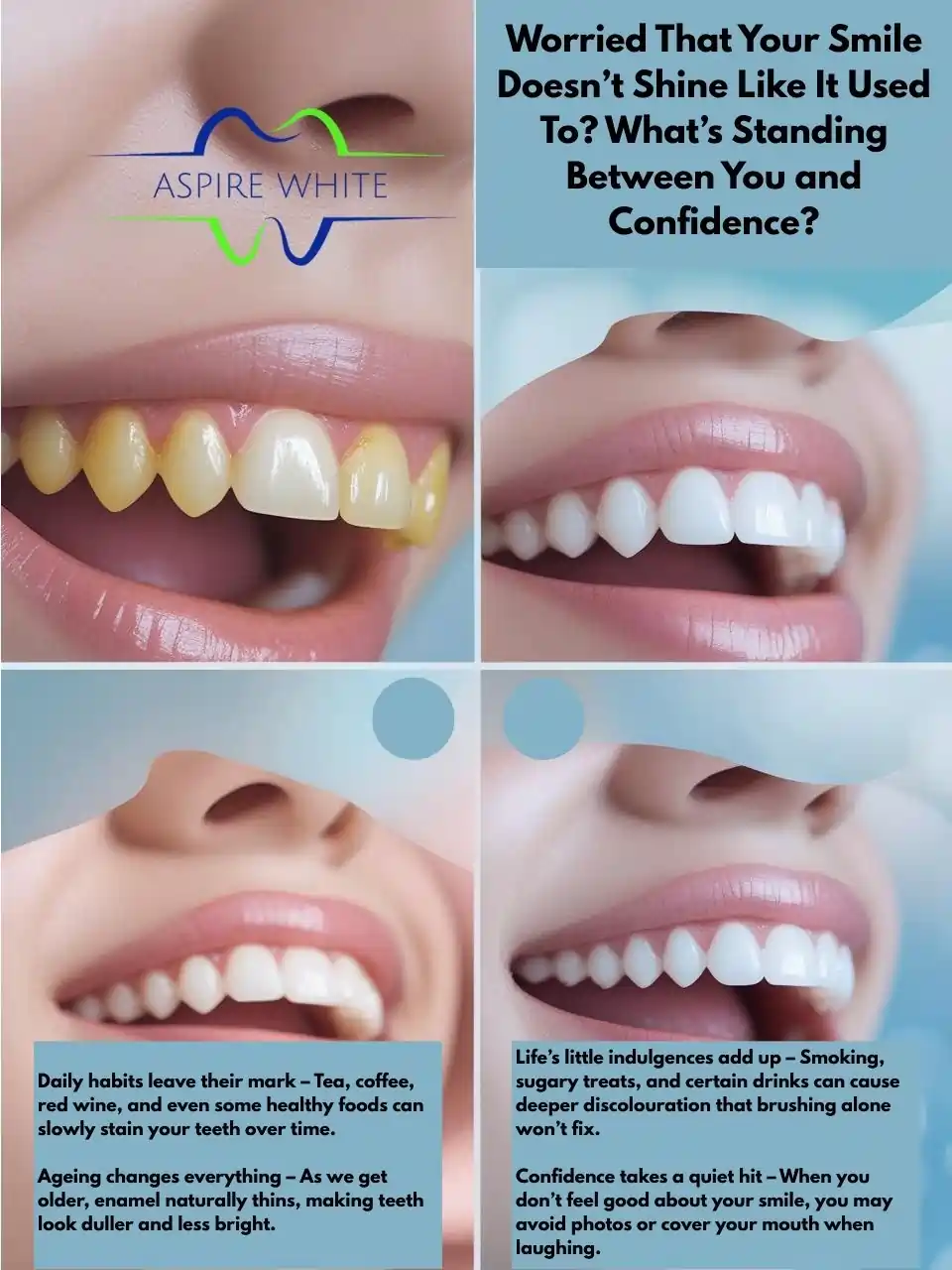 Worried That Your Smile Doesn’t Shine Like It Used To What’s Standing Between You and Confidence Swindon